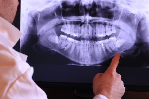Best Emergency Dental Surgery in Fort Lewis, WA